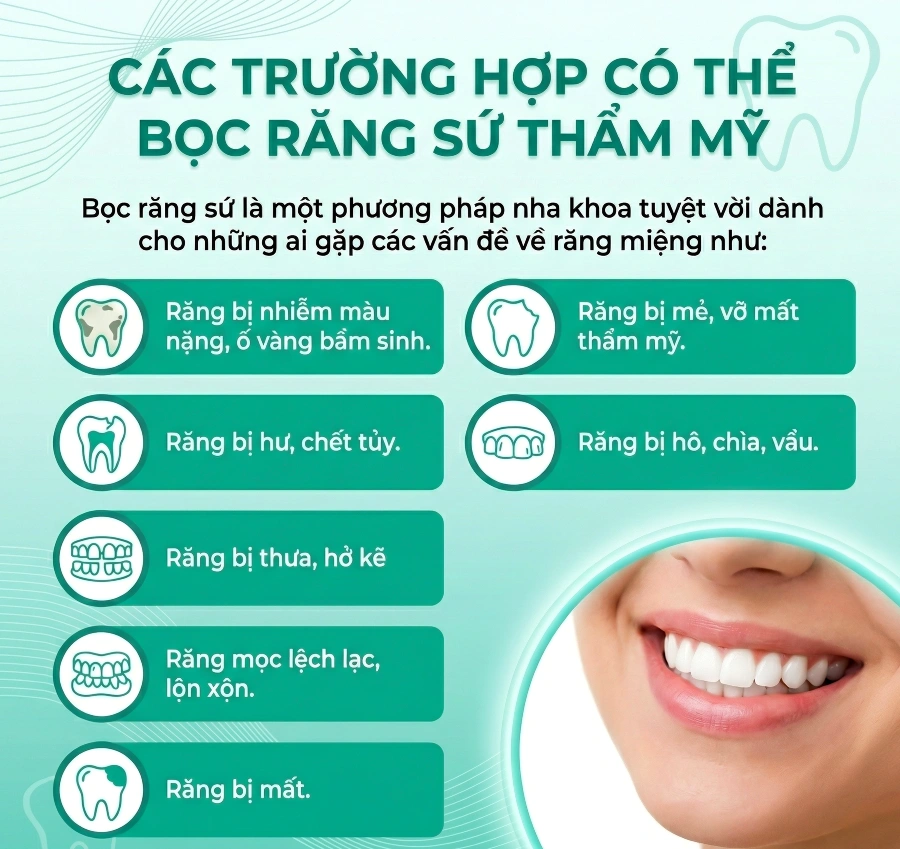 Các Trường Hợp Có Thể Bọc Răng Sứ Thẩm Mỹ