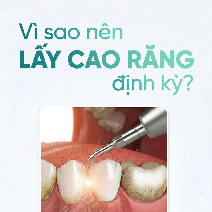 Vì Sao Đánh Răng Kỹ Vẫn Bị Hôi Miệng?