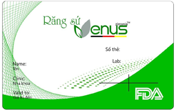 Venus